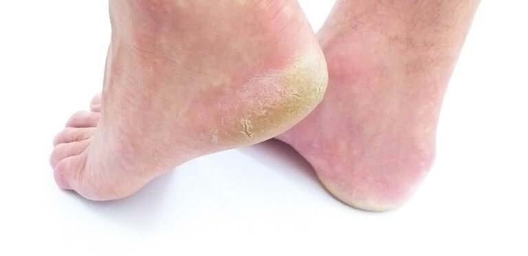 How Your Feet “Snitch” On Your Health The Benefits of Foot Reflexology